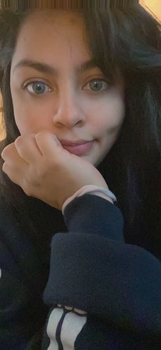Customer photo review of SL70 Blue Contact Lenses(12 months wear)