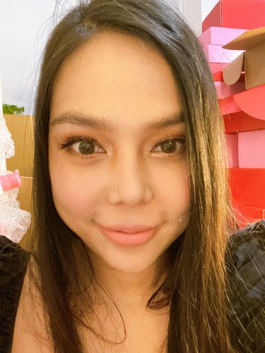 Customer photo review of Mark Traynor Single Face and Neck lift Kit