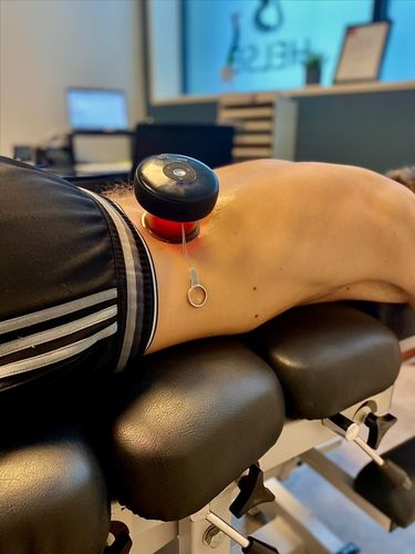 Customer photo review of Achedaway Cupper - The Smart Cupping Therapy Massager