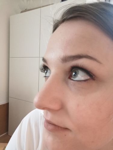 Customer photo review of GRATIS SmileSecret® Watermelonsmile