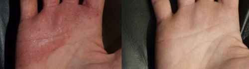 Customer photo review of Repair and Renew Cream