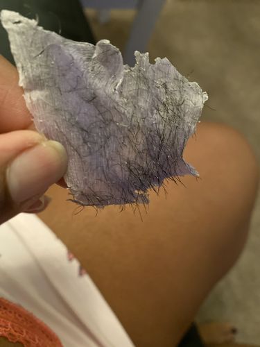 Customer photo review of At-Home Signature Series Hair Removal Wax