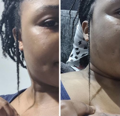 Customer photo review of Inches - Hair & Beard Growth Oil