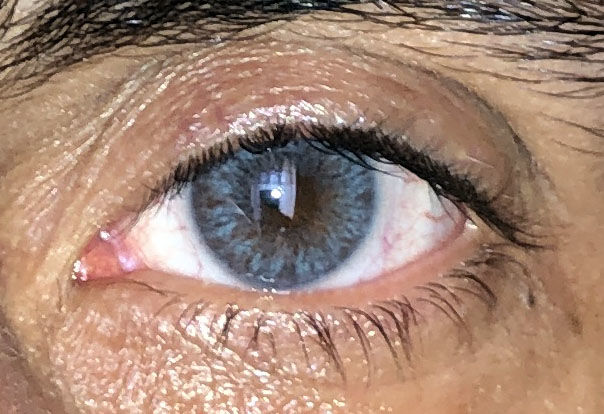 Customer photo review of Siesta Crystal Iris Blue