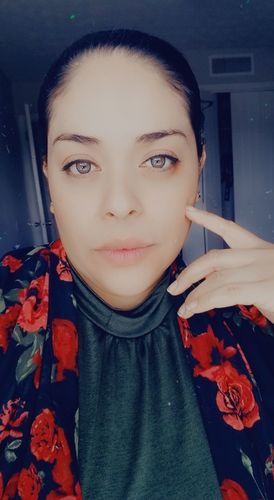 Customer photo review of Neala Green Contact Lenses(12 months wear)