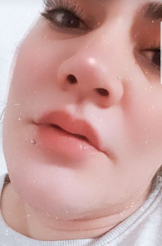 Customer photo review of LIP BOOSTING SERUM