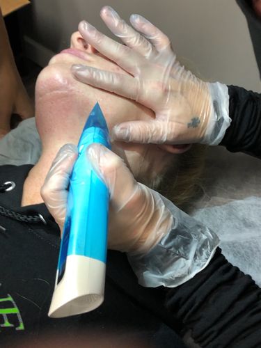 Customer photo review of Fibroblast Online Training