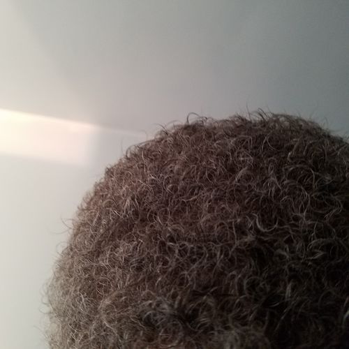 Customer photo review of (30%off)BEST SELLER (REGROWTH) Hair Serum Extra Strength