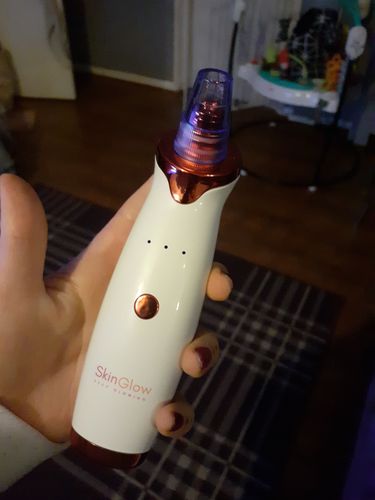 Customer photo review of SkinGlow Electric Cleanser - No More Blackheads