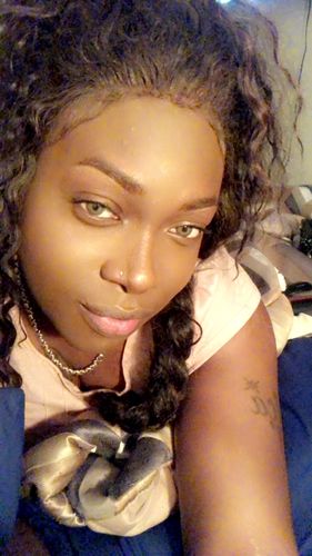 Customer photo review of SL70 Gray Contact Lenses(12 months wear)