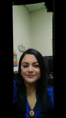 Customer photo review of Glassball Brown Contact Lenses