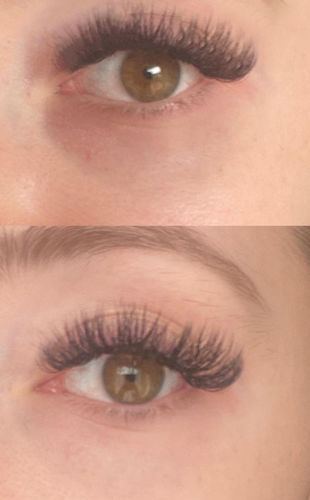 Customer photo review of Vitamin C gegen Augenschatten, Pickelmale und große Poren