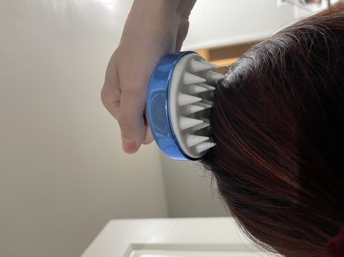 Customer photo review of ZenScalp