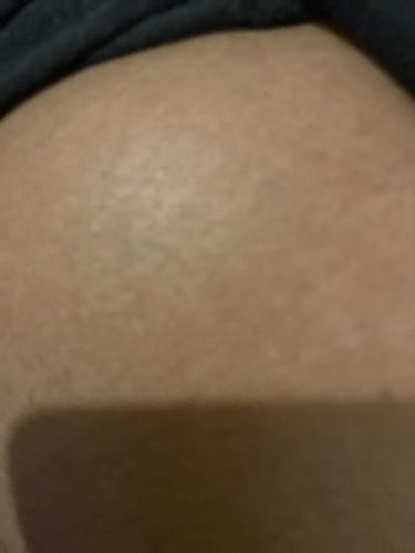 Customer photo review of NinetyX®—QuickWhite Body Gel