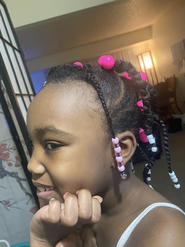 Customer photo review of Hair Regrowth Serum - Extra Strength (Large Bottle)