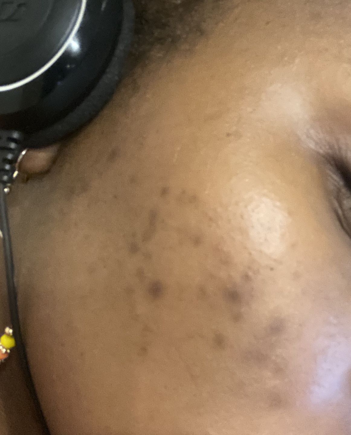 Customer photo review of SHEA SOAP