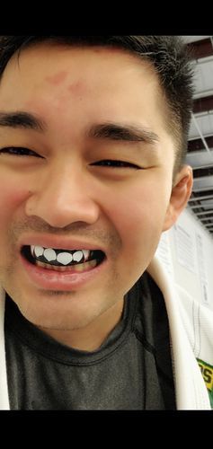 Customer photo review of 𝗔𝗣𝗘𝗫™ Bloodlust