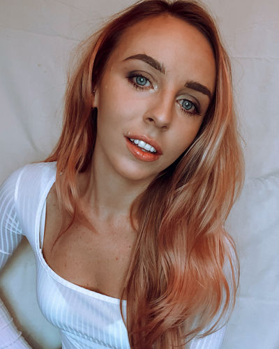 Customer photo review of Teeth Whitening Kit