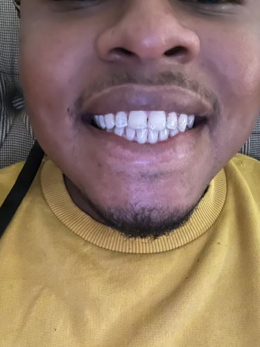 Customer photo review of Refill Kit