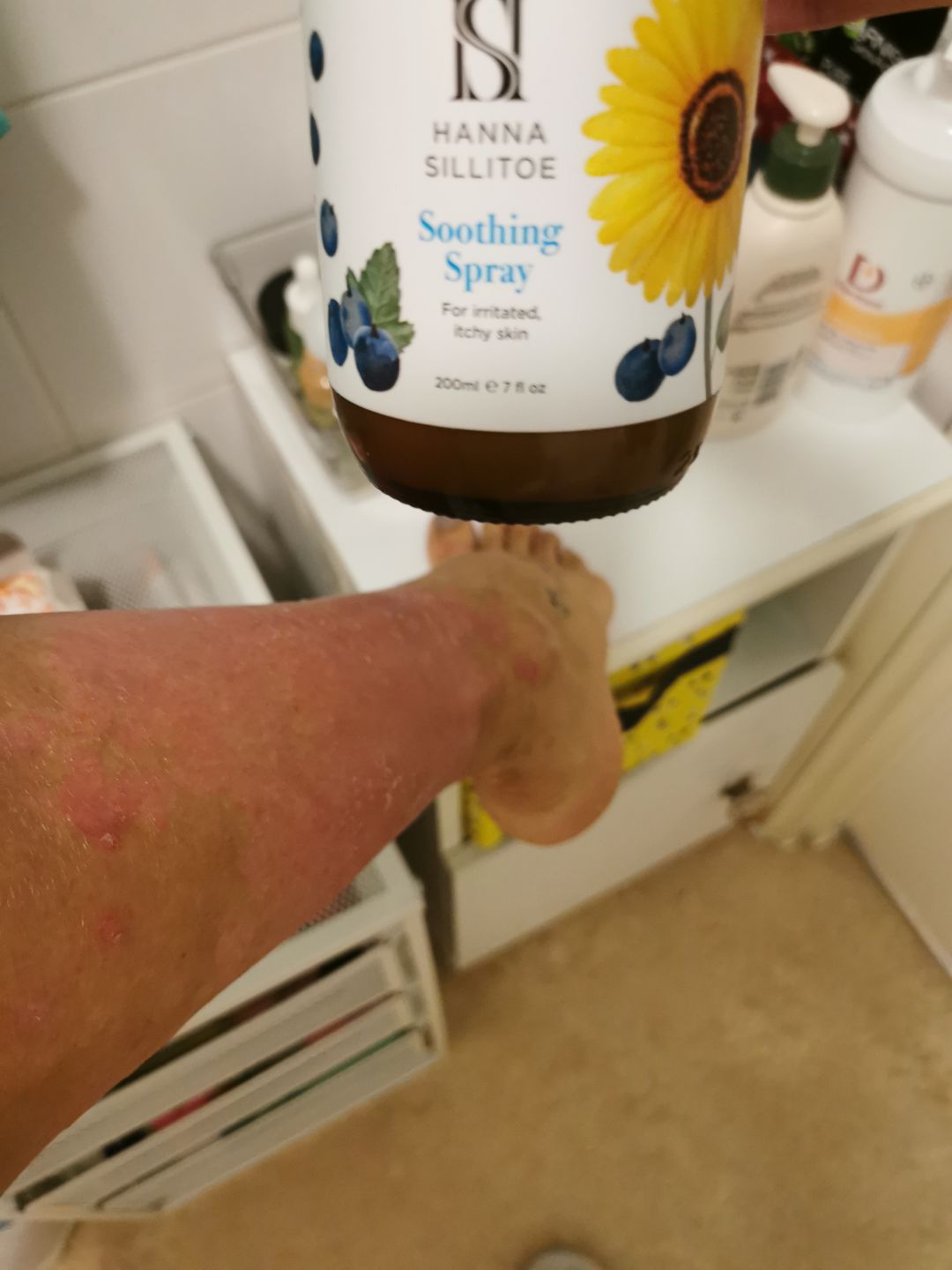 Customer photo review of Soothing Spray