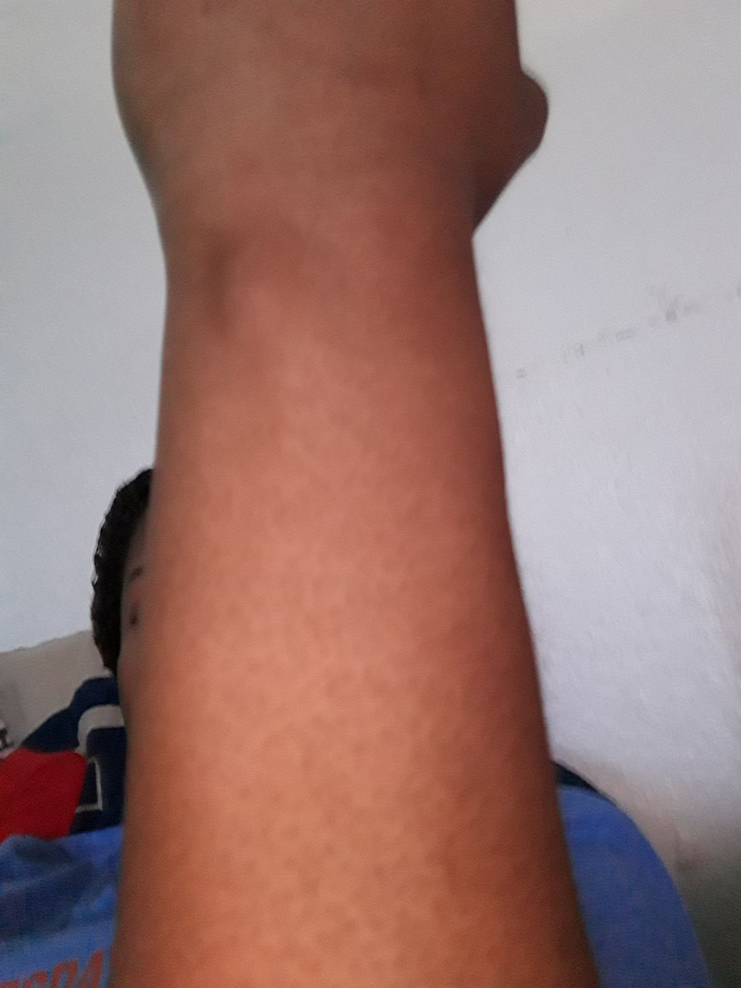 Customer photo review of Omic LightenUp PLUS Lightening Body Lotion - 400ml