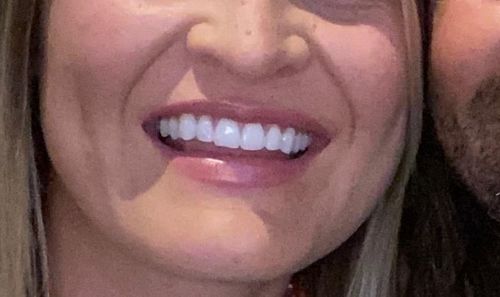 Customer photo review of Clareador Intensive Stain Removal