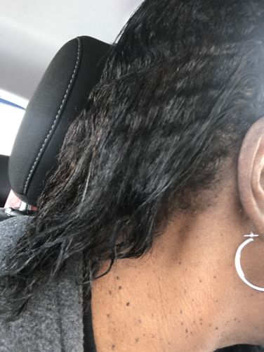 Customer photo review of Hair ReGrowth Serum - Best Friend Kit