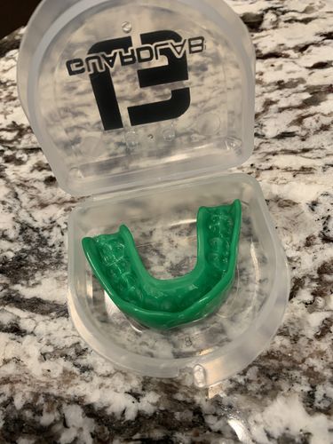 Customer photo review of 𝗔𝗣𝗘𝗫™ 𝗟𝗶𝘁𝗲- Green