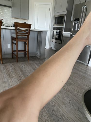 Customer photo review of Dermavel - Solo Kit