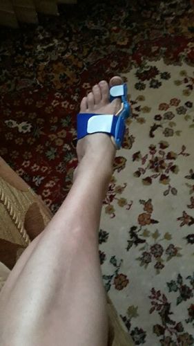 Customer photo review of Attelle correctrice d'oignons