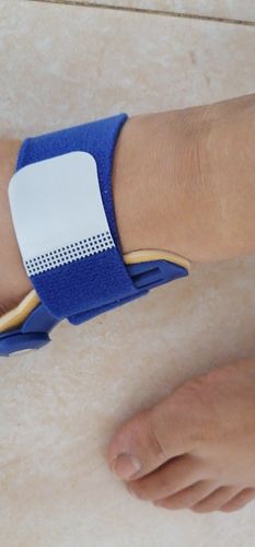 Customer photo review of Attelle correctrice d'oignons