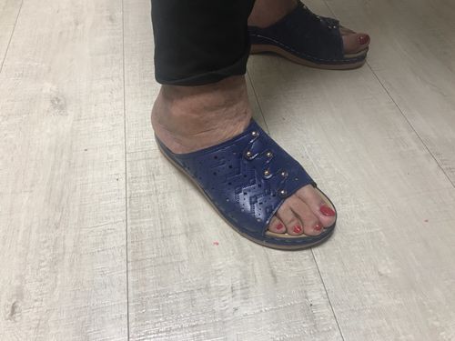 Customer photo review of Sandales Orthopédiques Lima