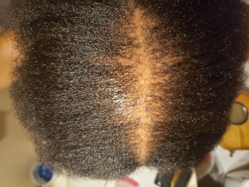 Customer photo review of Organic Hair Growth Oil
