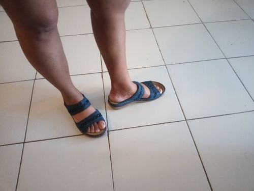 Customer photo review of Sandales Orthopédiques Romy