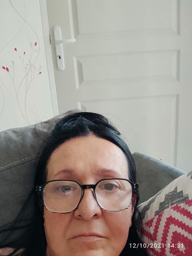 Customer photo review of Sérum Repulpant Visage
