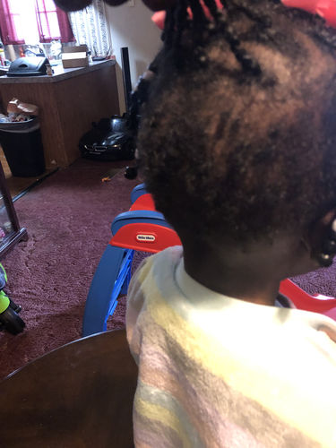 Customer photo review of Kid's Super healthy Hair kit