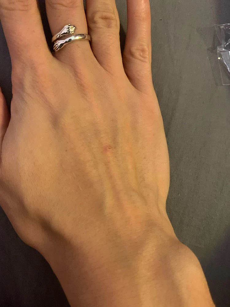 Customer photo review of Hug Ring