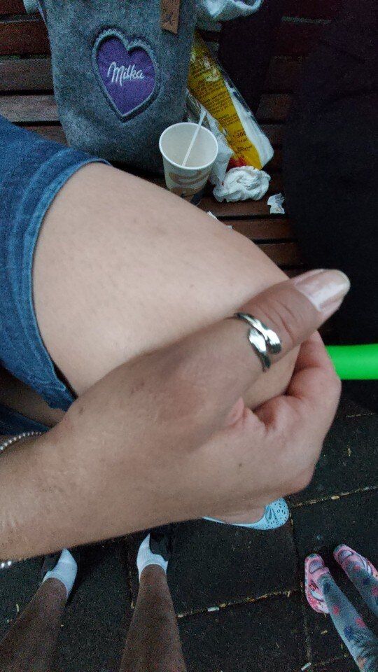 Customer photo review of Hug Ring