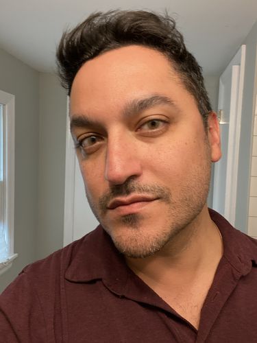 Customer photo review of Mel Prescription Contact Lenses