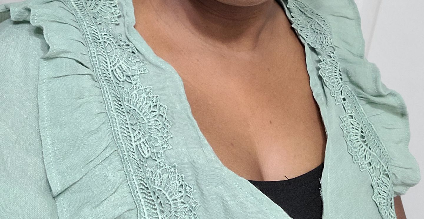 Customer photo review of Fair and White Original Brightening Serum 30 ml / 1 fl oz