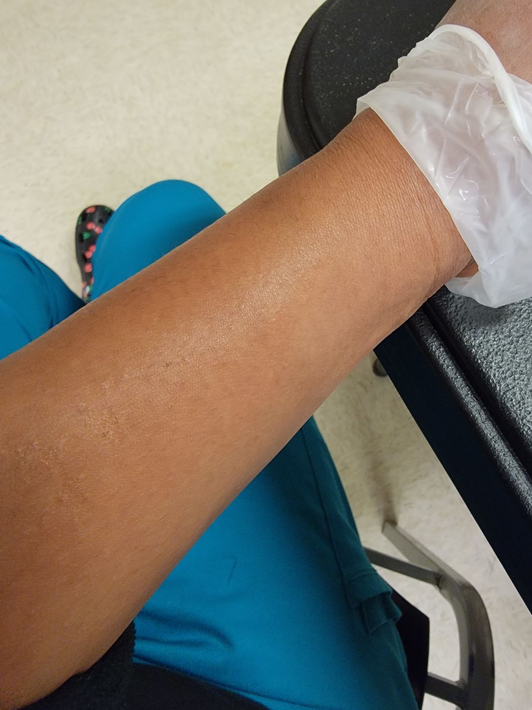 Customer photo review of Fair and White Glutathion Extra Serum Anti-Dark Spot 30ml / 1.01 Fl Oz