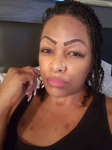 Customer photo review of Nose Cuffs