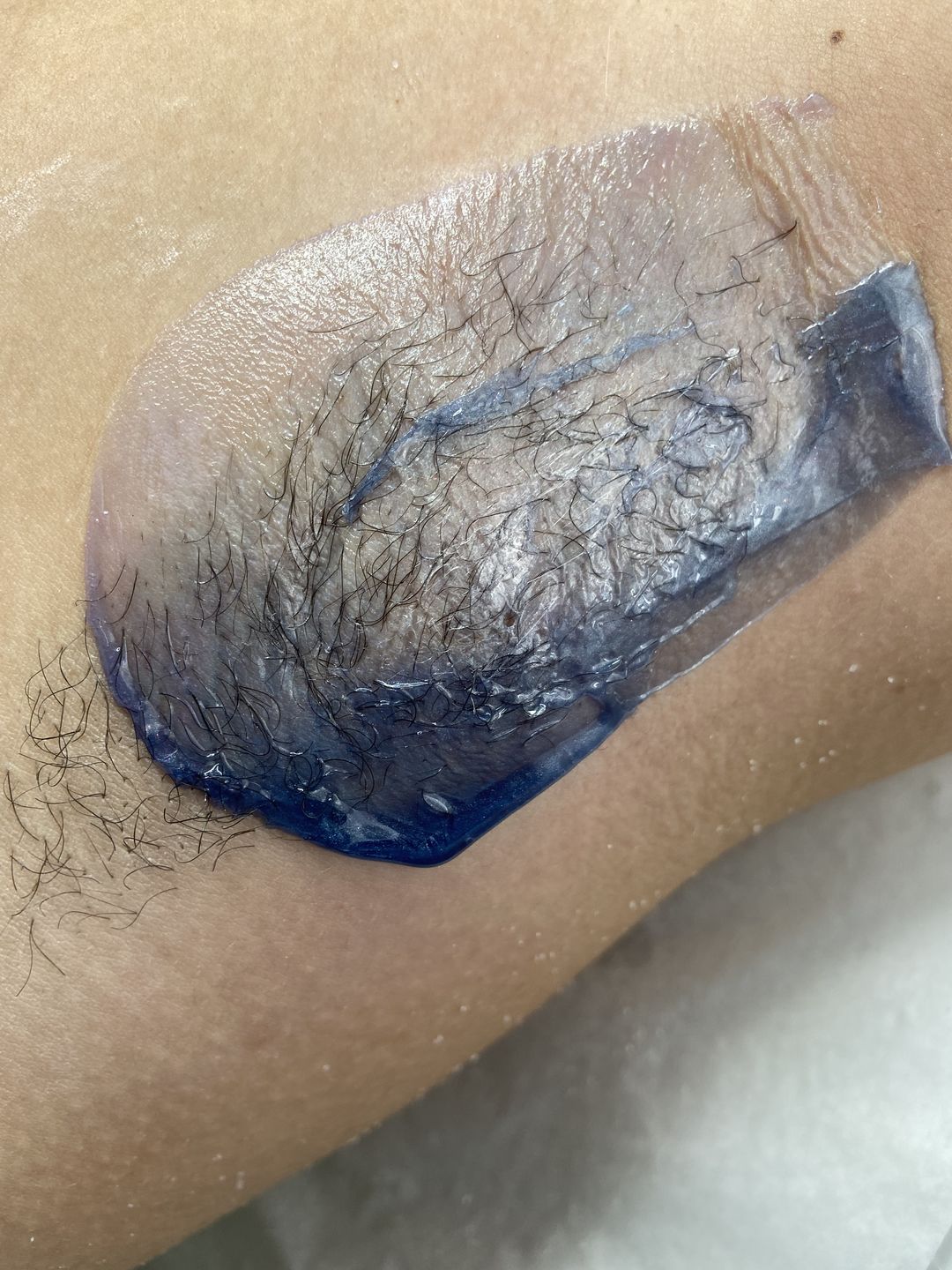 Customer photo review of At-Home Signature Series Hair Removal Wax