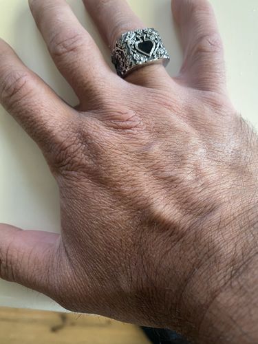 Customer photo review of CHAIN RING