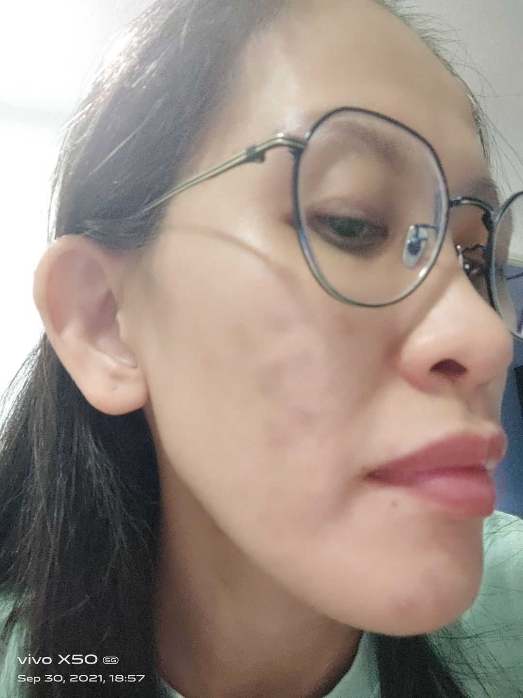Customer photo review of CLEF RADIANT GOLD ESSENCE (30ml)