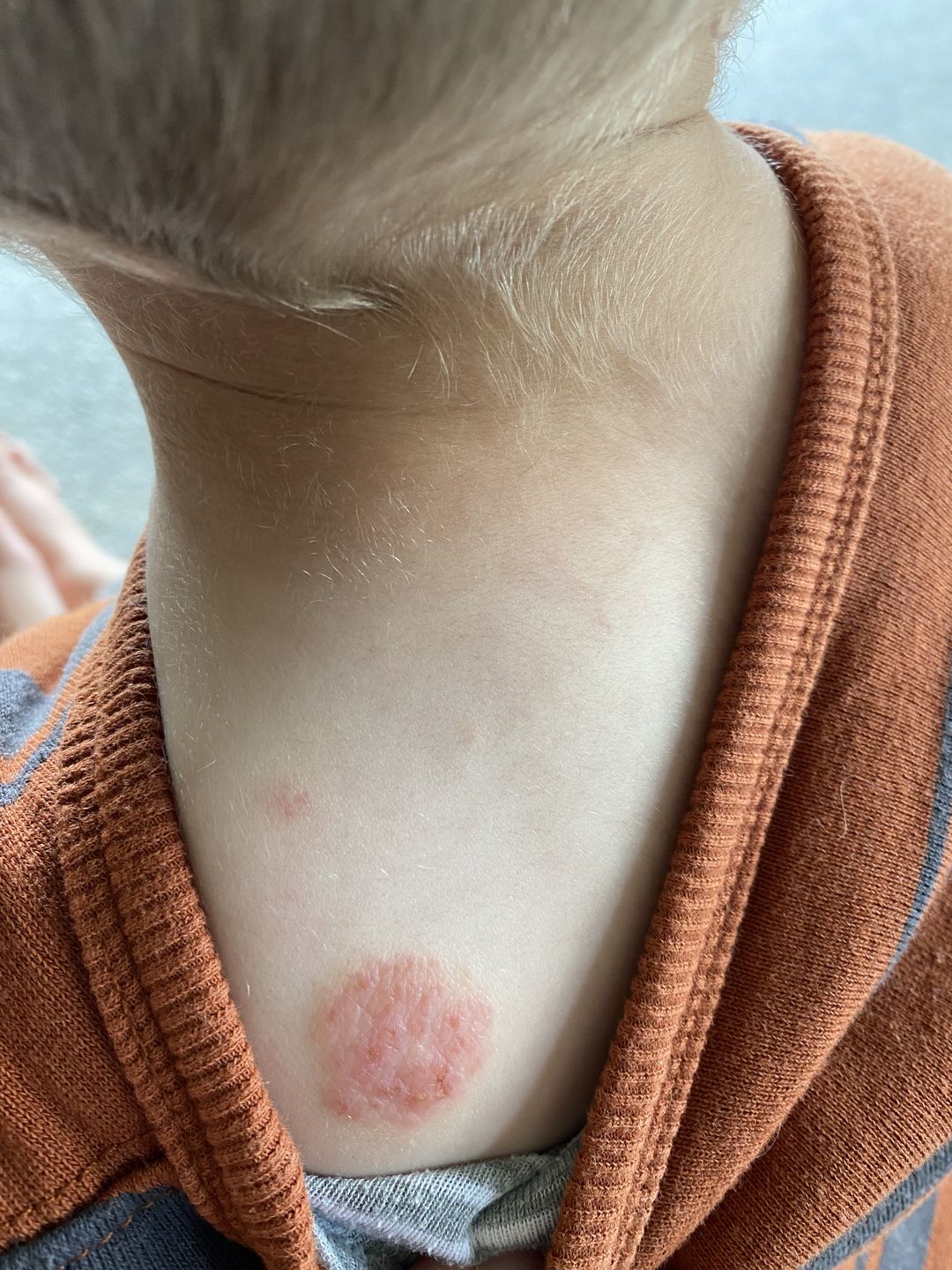 Customer photo review of Eczema Saviour