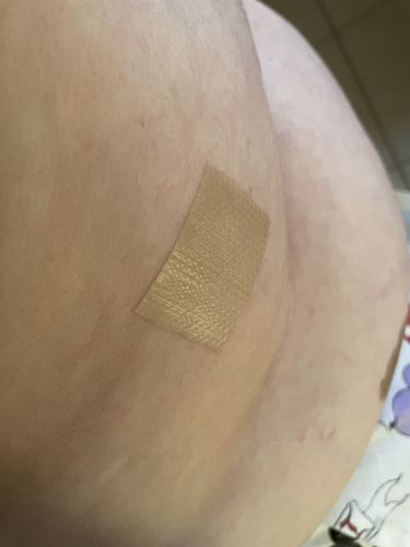 Customer photo review of Ultimate Mood Patch - 8 week Supply- Homeopathic Skin Patches