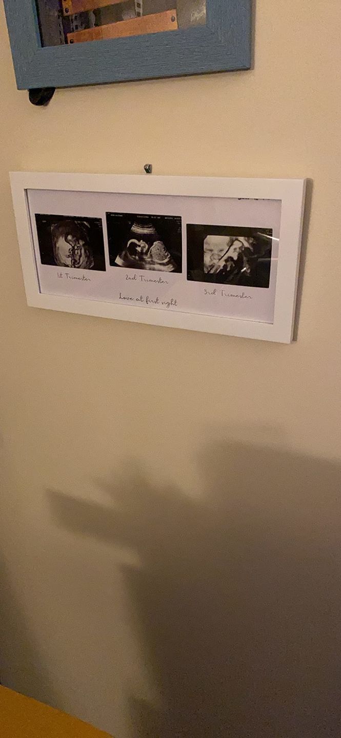 Customer photo review of TRIO Sonogram Frame