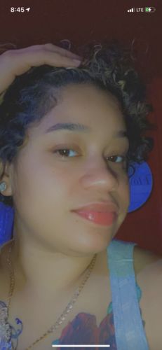 Customer photo review of SkinFix: Dermal Infusion