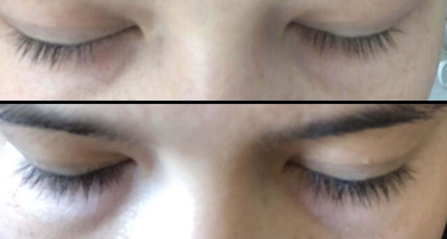 Customer photo review of Purely Lashes Lash Growth Serum